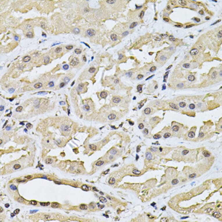 Immunohistochemistry - Anti-SP110 Antibody (A14003) - Antibodies.com