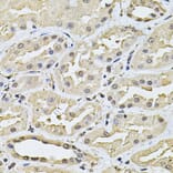 Immunohistochemistry - Anti-SP110 Antibody (A14003) - Antibodies.com
