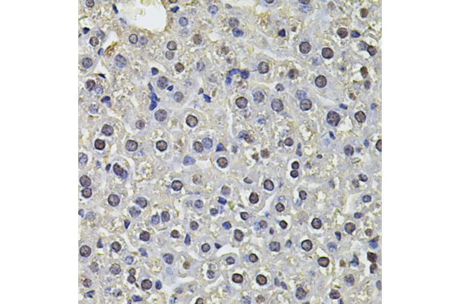 Immunohistochemistry - Anti-SP110 Antibody (A14003) - Antibodies.com