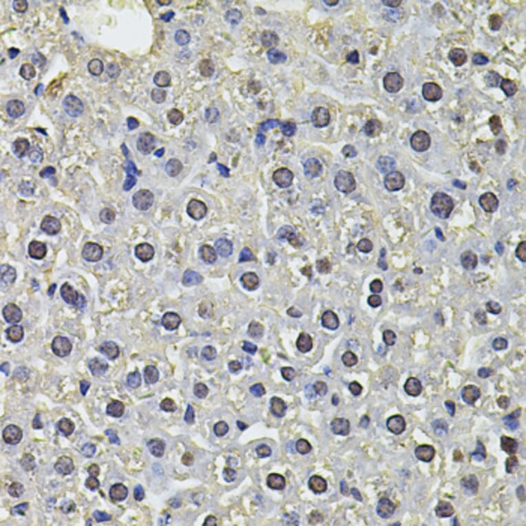 Immunohistochemistry - Anti-SP110 Antibody (A14003) - Antibodies.com