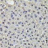 Immunohistochemistry - Anti-SP110 Antibody (A14003) - Antibodies.com