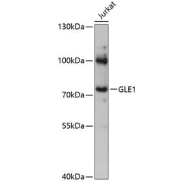 Western Blot - Anti-GLE1 Antibody (A91241) - Antibodies.com