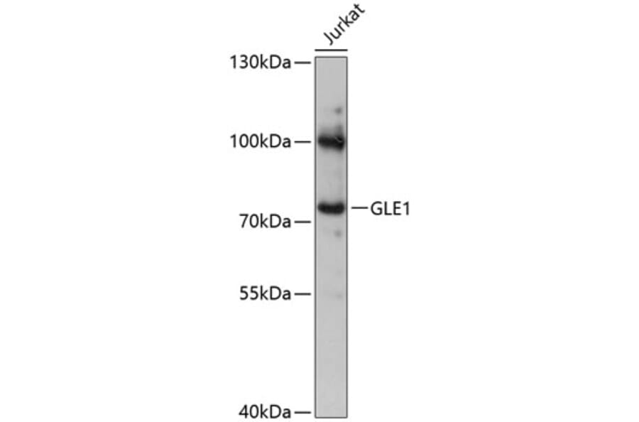 Western Blot - Anti-GLE1 Antibody (A91241) - Antibodies.com