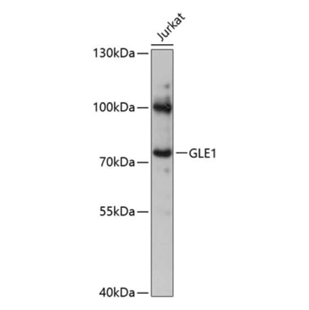 Western Blot - Anti-GLE1 Antibody (A91241) - Antibodies.com