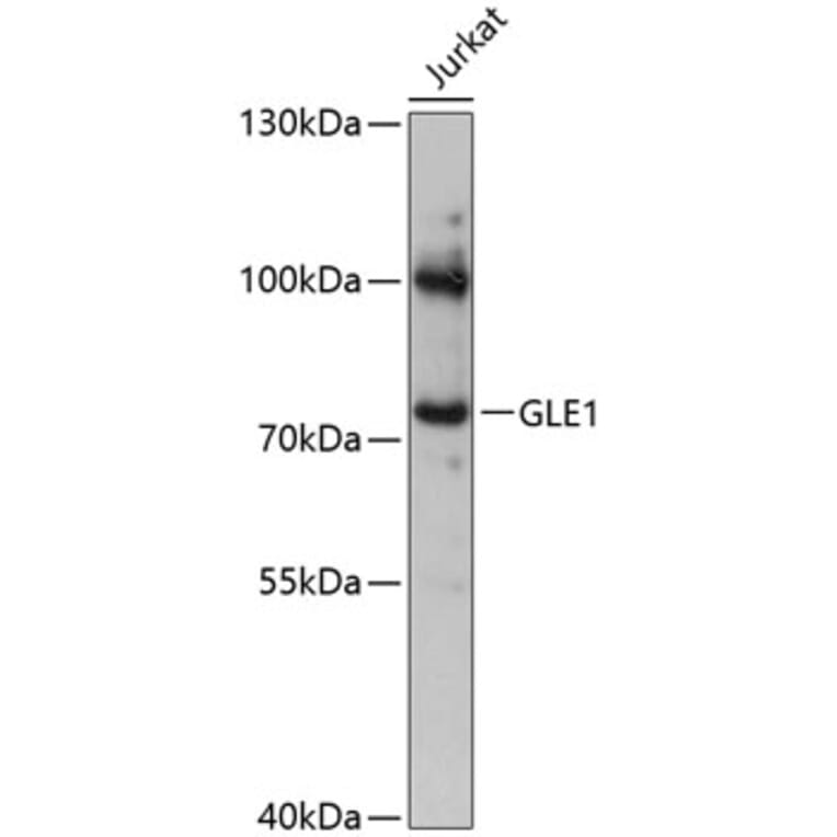 Western Blot - Anti-GLE1 Antibody (A91241) - Antibodies.com