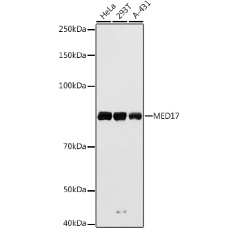 Western Blot - Anti-TRAP80 Antibody (A91242) - Antibodies.com