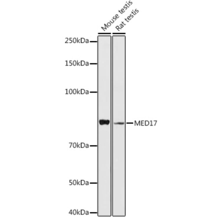 Western Blot - Anti-TRAP80 Antibody (A91242) - Antibodies.com
