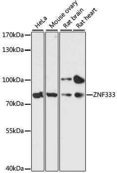 Western blot analysis of extracts of various cell lines, using Anti-ZNF333 Antibody (A13848) at 1:3000 dilution.
Secondary antibody: Goat Anti-Rabbit IgG (H+L) (HRP) (AS014) at 1:10,000 dilution.
Lysates / proteins: 25µg per lane.
Blocking buffer: 3% non-fat dry milk in TBST.
Detection: ECL Basic Kit (RM00020).
Exposure time: 90s.