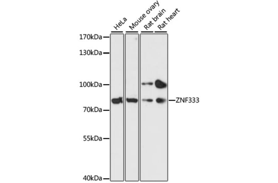 Western Blot - Anti-ZNF333 Antibody (A91243) - Antibodies.com