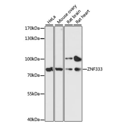 Western Blot - Anti-ZNF333 Antibody (A91243) - Antibodies.com
