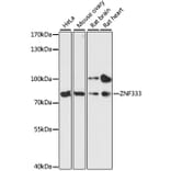 Western Blot - Anti-ZNF333 Antibody (A91243) - Antibodies.com