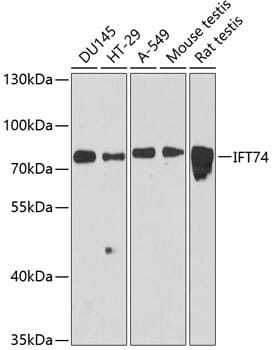 Western blot analysis of extracts of various cell lines, using Anti-IFT74 Antibody (A12672) at 1:3000 dilution.
Secondary antibody: Goat Anti-Rabbit IgG (H+L) (HRP) (AS014) at 1:10,000 dilution.
Lysates / proteins: 25µg per lane.
Blocking buffer: 3% non-fat dry milk in TBST.
Detection: ECL Basic Kit (RM00020).
Exposure time: 90s.