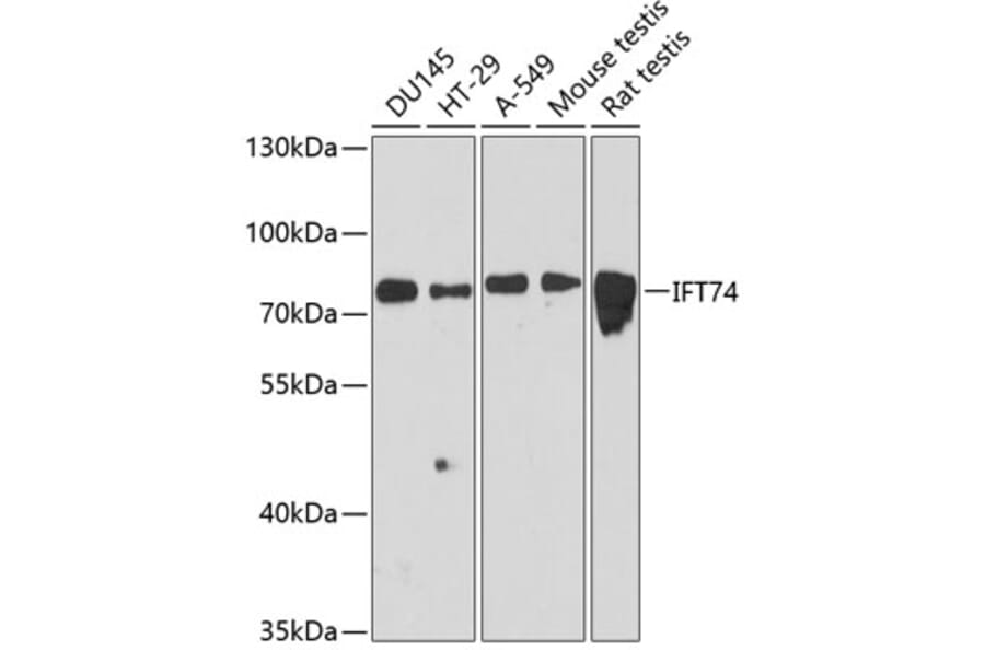 Western Blot - Anti-IFT74 Antibody (A91244) - Antibodies.com
