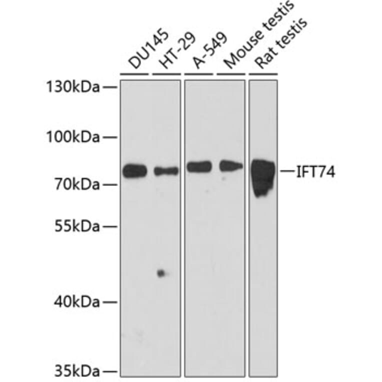 Western Blot - Anti-IFT74 Antibody (A91244) - Antibodies.com