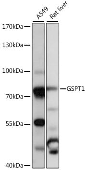 Western blot analysis of extracts of various cell lines, using Anti-GSPT1 Antibody (A16214) at 1:1,000 dilution.
Secondary antibody: Goat Anti-Rabbit IgG (H+L) (HRP) (AS014) at 1:10,000 dilution.
Lysates / proteins: 25µg per lane.
Blocking buffer: 3% non-fat dry milk in TBST.
Detection: ECL Basic Kit (RM00020).
Exposure time: 1s.