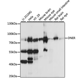 Western Blot - Anti-DNER Antibody (A91246) - Antibodies.com