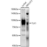 Western Blot - Anti-TLK1 (phospho hospho S743) Antibody (A91247) - Antibodies.com