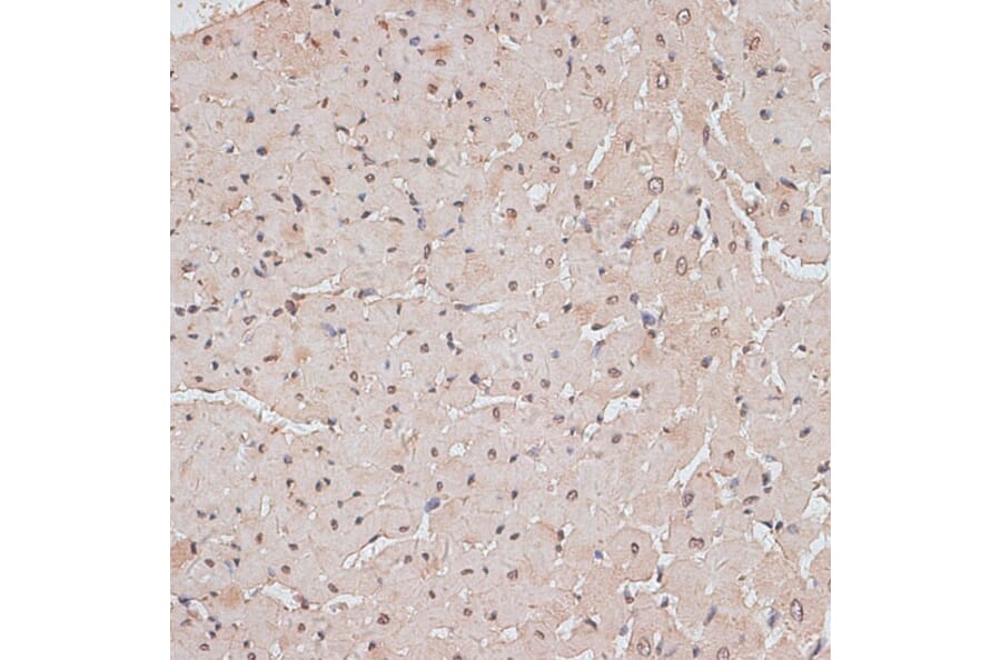 Immunohistochemistry - Anti-TLK1 (phospho hospho S743) Antibody (A91247) - Antibodies.com