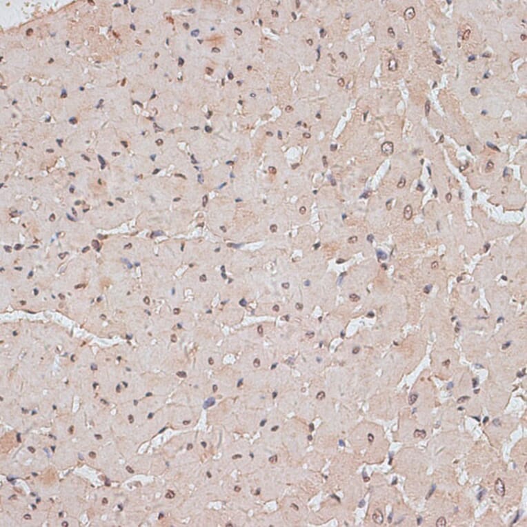 Immunohistochemistry - Anti-TLK1 (phospho hospho S743) Antibody (A91247) - Antibodies.com