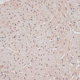 Immunohistochemistry - Anti-TLK1 (phospho hospho S743) Antibody (A91247) - Antibodies.com