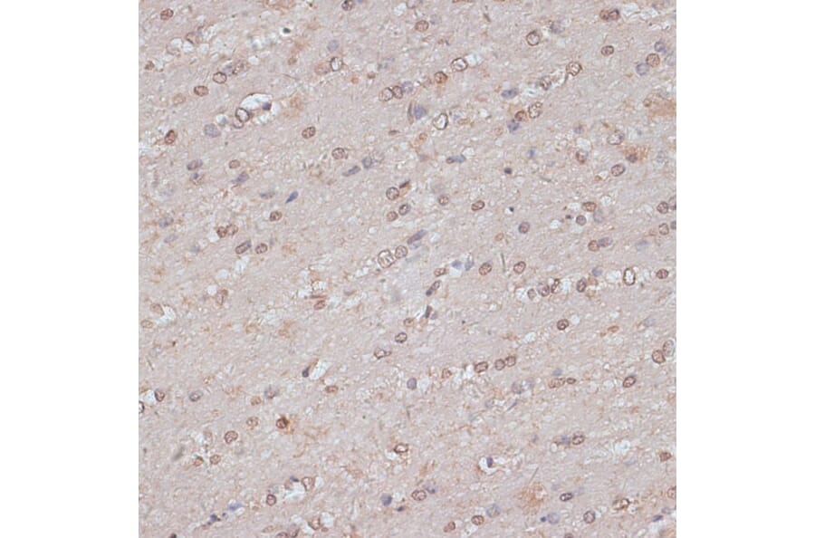 Immunohistochemistry - Anti-TLK1 (phospho hospho S743) Antibody (A91247) - Antibodies.com