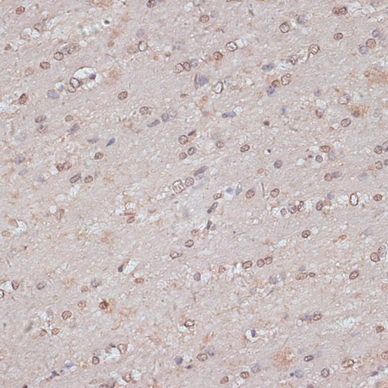 Immunohistochemistry - Anti-TLK1 (phospho hospho S743) Antibody (A91247) - Antibodies.com