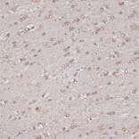 Immunohistochemistry - Anti-TLK1 (phospho hospho S743) Antibody (A91247) - Antibodies.com