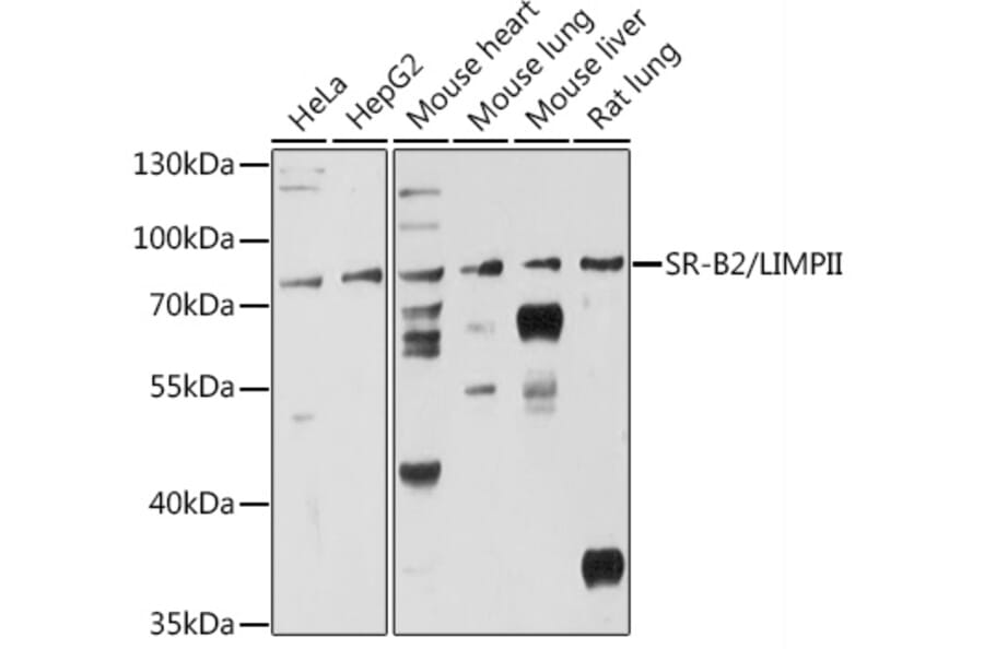 Western Blot - Anti-Scavenging Receptor SRB2 Antibody (A91248) - Antibodies.com