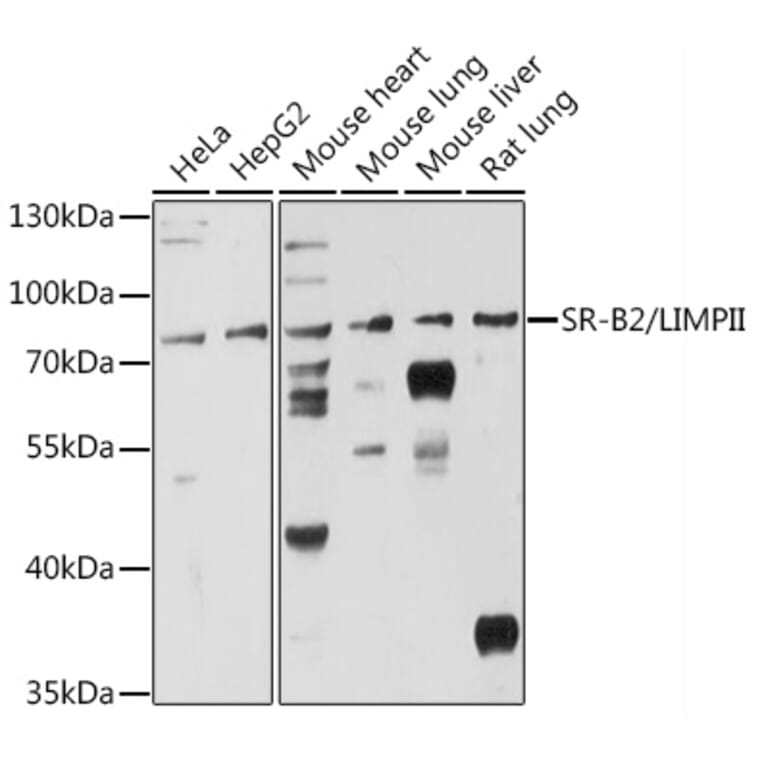 Western Blot - Anti-Scavenging Receptor SRB2 Antibody (A91248) - Antibodies.com