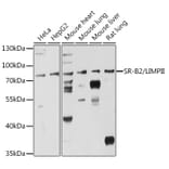 Western Blot - Anti-Scavenging Receptor SRB2 Antibody (A91248) - Antibodies.com