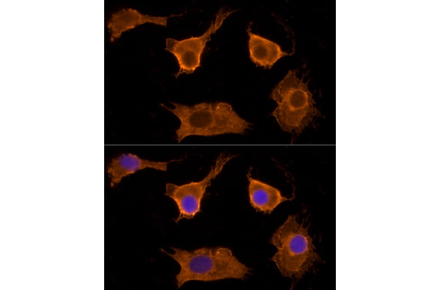 Immunofluorescence - Anti-Scavenging Receptor SRB2 Antibody (A91248) - Antibodies.com
