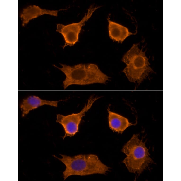 Immunofluorescence - Anti-Scavenging Receptor SRB2 Antibody (A91248) - Antibodies.com