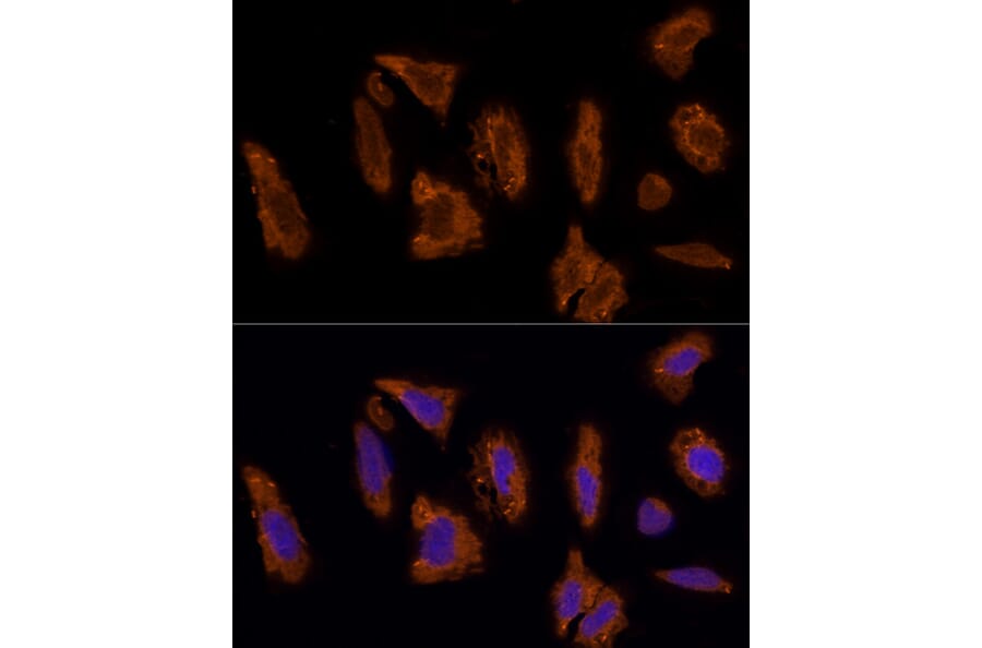 Immunofluorescence - Anti-Scavenging Receptor SRB2 Antibody (A91248) - Antibodies.com