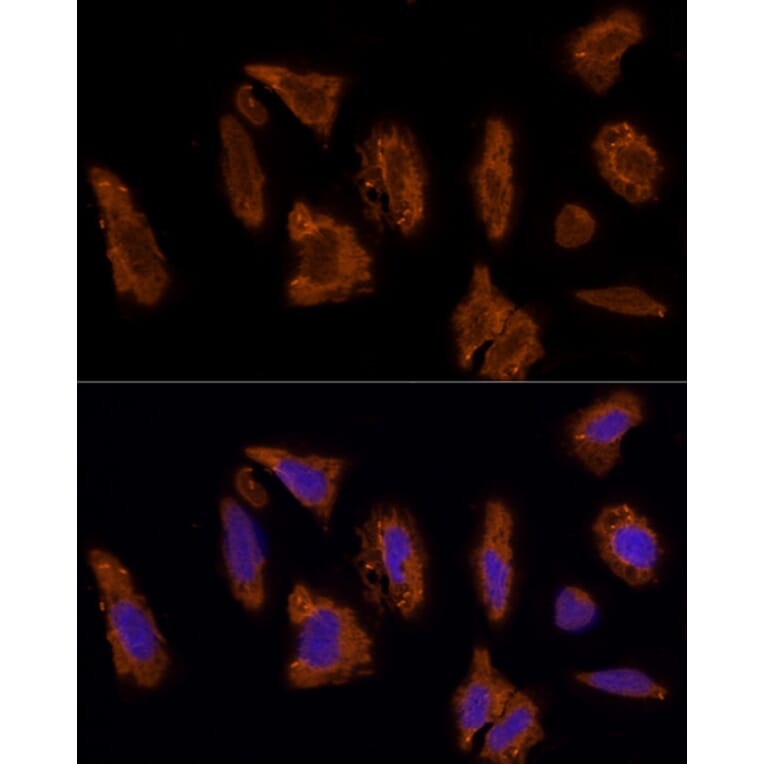 Immunofluorescence - Anti-Scavenging Receptor SRB2 Antibody (A91248) - Antibodies.com