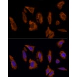 Immunofluorescence - Anti-Scavenging Receptor SRB2 Antibody (A91248) - Antibodies.com