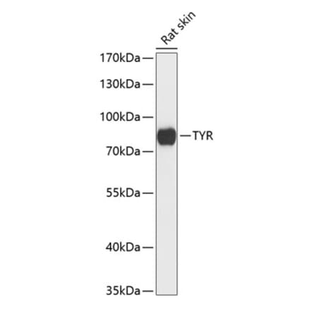 Western Blot - Anti-Tyrosinase Antibody (A91249) - Antibodies.com