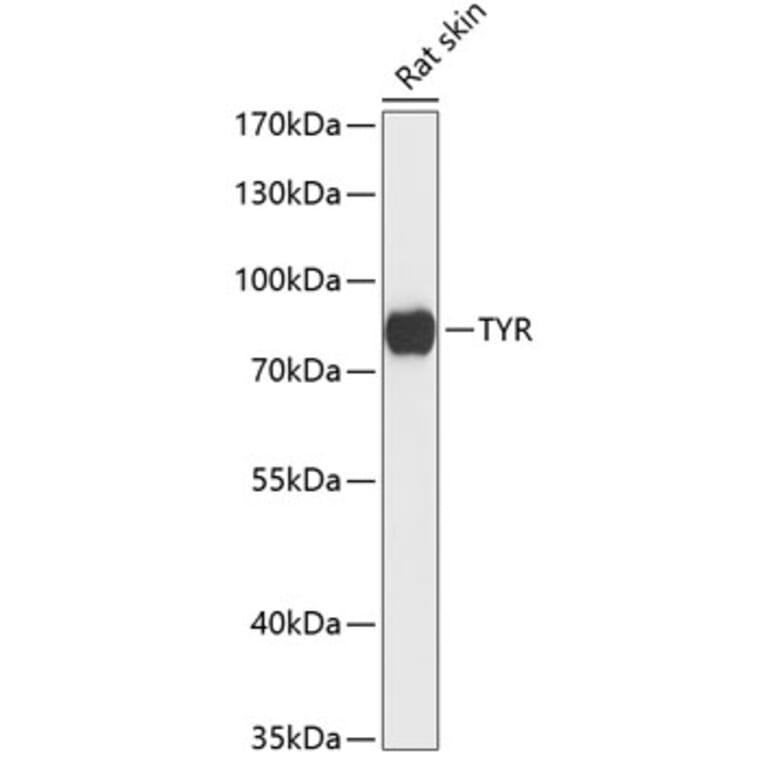 Western Blot - Anti-Tyrosinase Antibody (A91249) - Antibodies.com