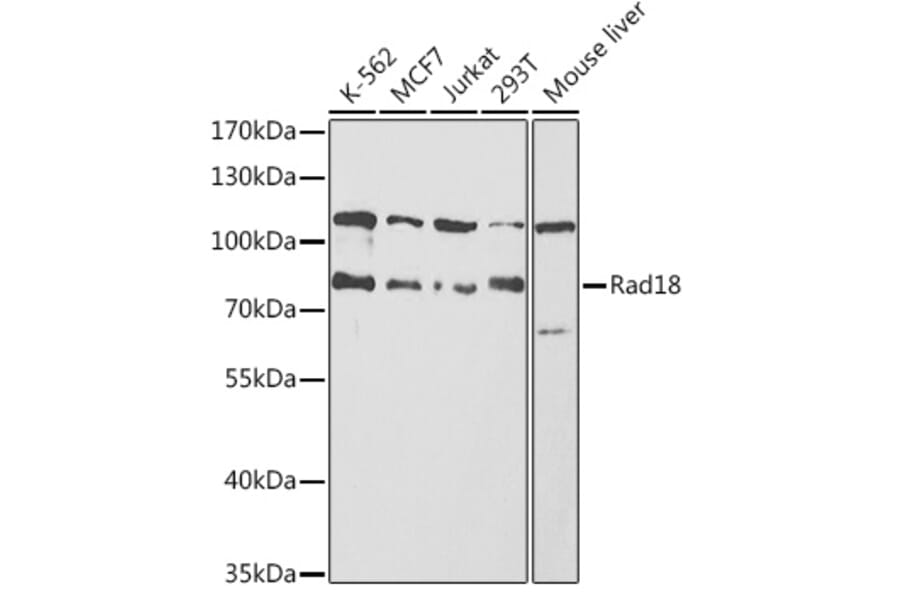 Western Blot - Anti-RAD18 Antibody (A91251) - Antibodies.com
