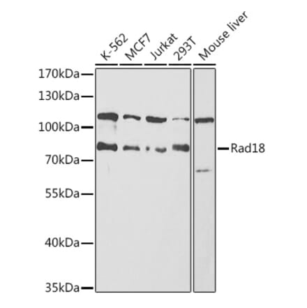 Western Blot - Anti-RAD18 Antibody (A91251) - Antibodies.com