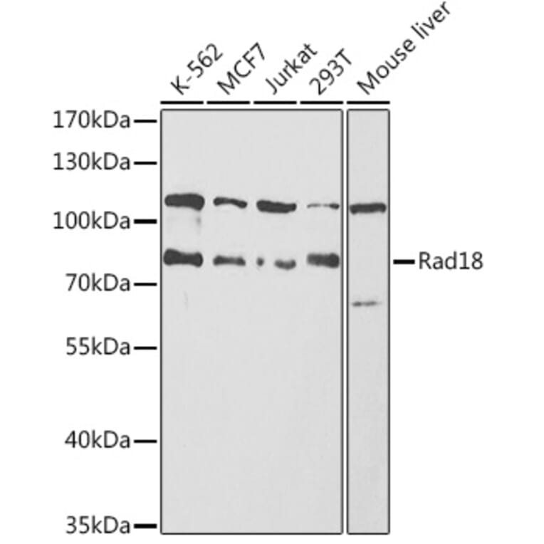Western Blot - Anti-RAD18 Antibody (A91251) - Antibodies.com