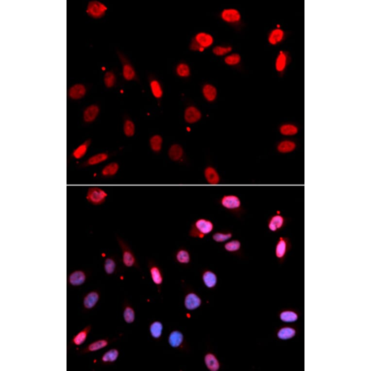 Immunofluorescence - Anti-RAD18 Antibody (A91251) - Antibodies.com