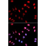 Immunofluorescence - Anti-RAD18 Antibody (A91251) - Antibodies.com