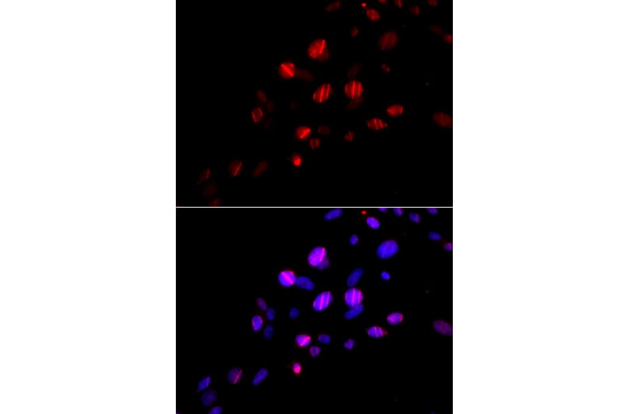 Immunofluorescence - Anti-RAD18 Antibody (A91251) - Antibodies.com