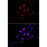 Immunofluorescence - Anti-RAD18 Antibody (A91251) - Antibodies.com