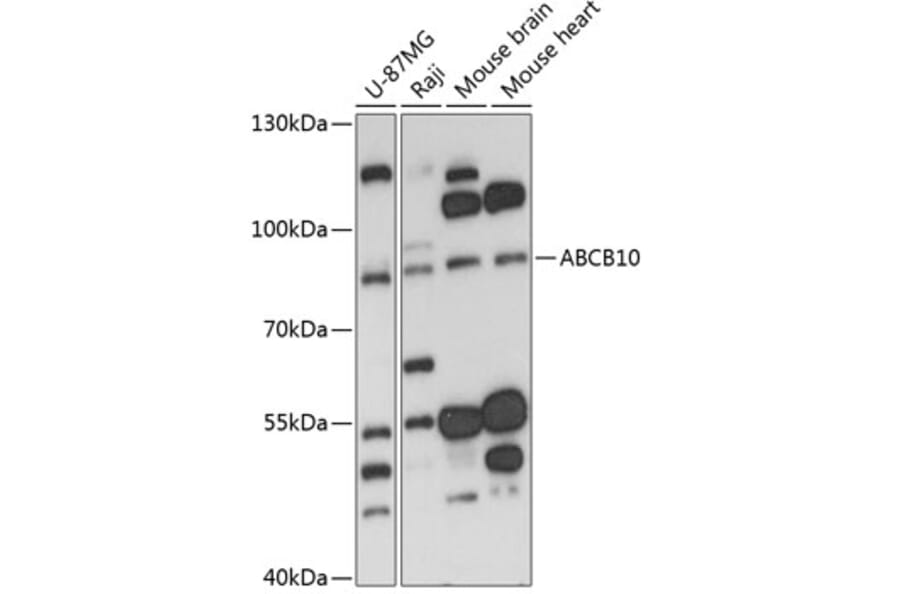 Western Blot - Anti-ABCB10 Antibody (A91252) - Antibodies.com