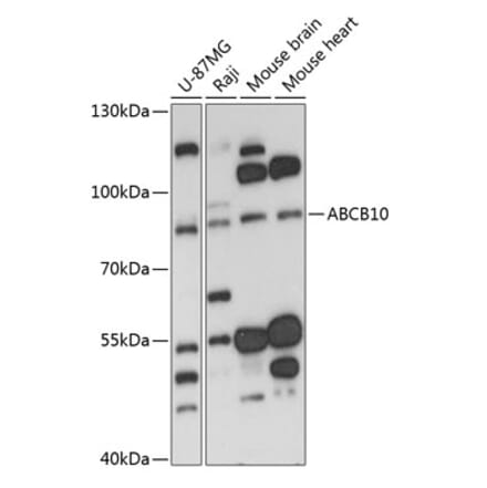 Western Blot - Anti-ABCB10 Antibody (A91252) - Antibodies.com