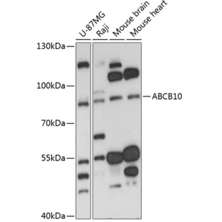 Western Blot - Anti-ABCB10 Antibody (A91252) - Antibodies.com