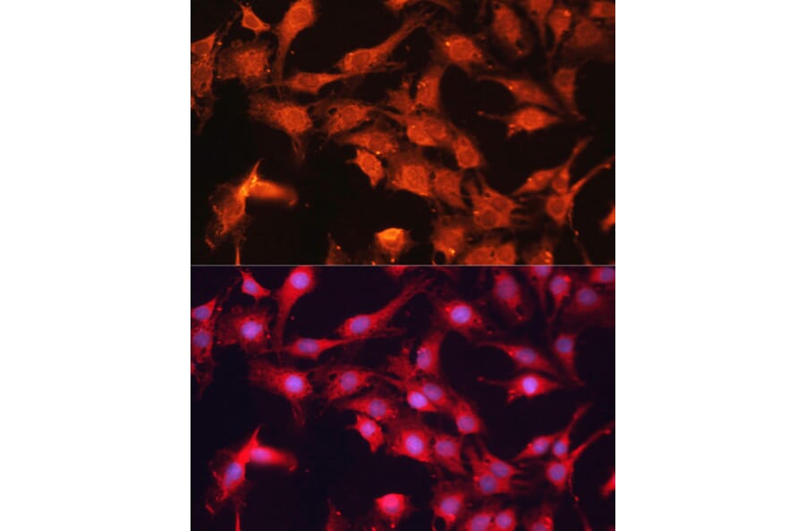 Immunofluorescence - Anti-ABCB10 Antibody (A91252) - Antibodies.com