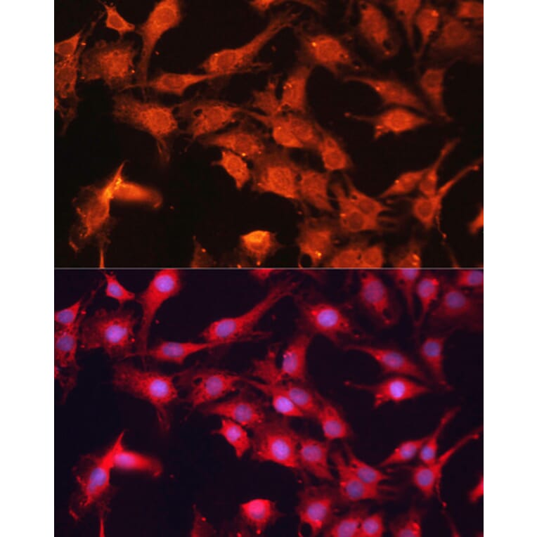 Immunofluorescence - Anti-ABCB10 Antibody (A91252) - Antibodies.com