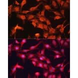 Immunofluorescence - Anti-ABCB10 Antibody (A91252) - Antibodies.com